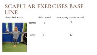 Injury Prevention For Shoulder Subluxation [upl. by Ycniuq]