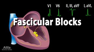 Fascicular Blocks Animation [upl. by Hollyanne29]