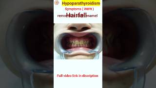 Hypoparathyroidism symptoms in hindi  shorts shortsfeeds [upl. by Ilsa]