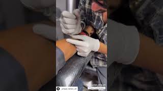 Tattoo Removal 💯 tattoodesigns tattooremoval removal [upl. by Amrak]