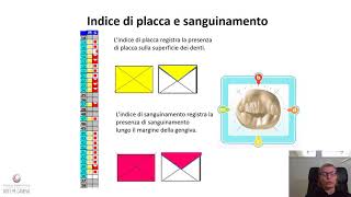 Valutazione della Parodontite  Status Radiografico e Sondaggio Parodontale [upl. by Noli]