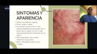 QUERATOSIS ACTÍNICA  Jorge Tamara  Rot 2524 DERMATOLOGÍA [upl. by Lerim]