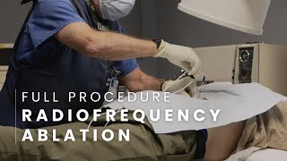 Radiofrequency Ablation Full Procedure  Lumbar [upl. by Salene732]