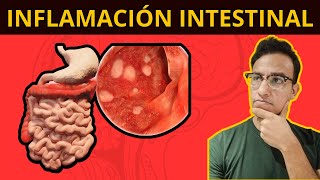 5 COSAS QUE TE INFLAMAN EL INTESTINO Síndrome de Intestino Irritable [upl. by Nazario]