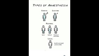 Anesthesia preassessmenttypesscalesASA Malam Patti Cormac Lehan medicsindicationscontra [upl. by Hewitt]