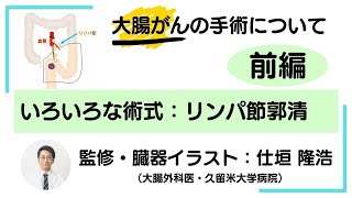 大腸がんの手術について：前編【術式の種類と違い、リンパ節郭清とは】「直腸がん大事典」 [upl. by Henley532]