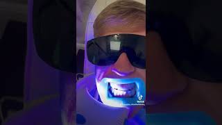 Amazing Teeth Whitening Transformations Before amp After  Mr White Teeth Whitening Bournemouth [upl. by Corabella]