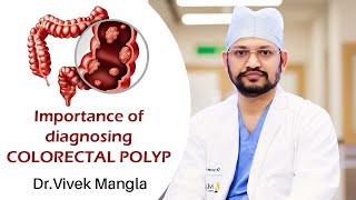 Colorectal polyps What are they and whats their link to colorectal cancer [upl. by Anawait838]