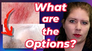 Treatments for Allergies  Vets Voice Atopic Dermatitis Part 2 [upl. by Aetnahc]