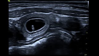 Canine foetal pole imaged on ScanPad and Vinno D6 [upl. by Enenstein]