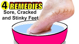 4 Effective Home Remedies for Sore Cracked and Stinky Feet [upl. by Ylatan]