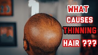 Best Haircut For BALDING MEN  Thinning Hair techniques  Episode 3 [upl. by Enelaj]