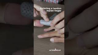 Mallet finger splint demo [upl. by Nwahsyar441]