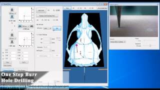 Neurostar  Drill amp Injection Robot [upl. by Shaddock]