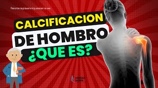 ✅ CALCIFICACIÓN DE HOMBRO ¿QUÉ ES [upl. by Shirberg48]