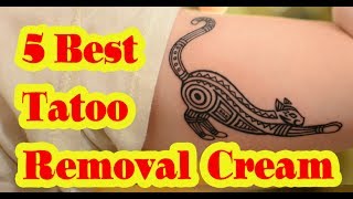 Best Tattoo Removal Cream to buy in 2020 [upl. by Lahcim]