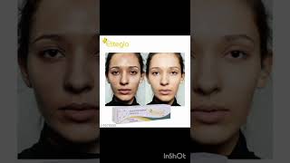 Eliteglo cream ke fayde short video health care hub [upl. by Robison]