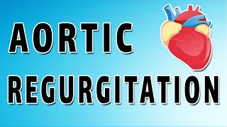 Aortic Insufficiency [upl. by Annavas606]