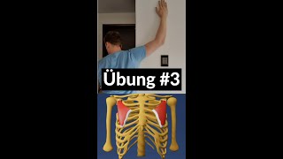 Übung 3 Training mit Trichterbrust  Pectoralis minor  Eckart Klobe Christoph Schlüter [upl. by Lizzy296]