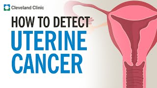 How Is Uterine Cancer Diagnosed [upl. by Cooperstein]