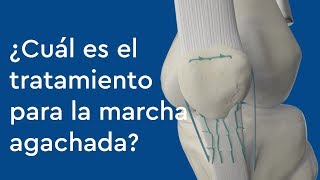 ¿Cuál es el tratamiento para la marcha agachada [upl. by Alderson]