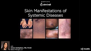 Skin Manifestations of Systemic Disease  November 5 2020 [upl. by Alleon]