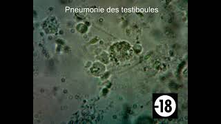 Pneumonie des testiboules au microscope [upl. by Lapham315]