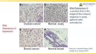 Scleroderma and Cancer What are the Connections Laura K Hummers MD ScM [upl. by Solange14]