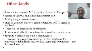 Muscular Dystrophy  Myotonic Dystrophy  Part 10 [upl. by Siravaj]