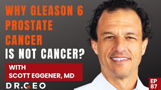 Why Gleason 6 Prostate Cancer is Not Cancer with Dr Scott Eggener EP 87 [upl. by Trinatte]