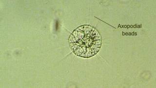 heliozoan reorganization axopodia formation [upl. by Ssilb]