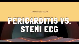 Distinguishing Pericarditis from STEMI A Comparative ECG Analysis [upl. by Acirej86]