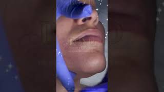 Buccal Intraoral Facial Massage a deeptissue massaging the muscles and lymph nodes of faceneck [upl. by Uah646]