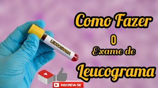 COMO FAZER O EXAME DE LEUCOGRAMA [upl. by Nobe]