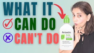 AmLactin Daily Reviewed Is It Worth The Hype [upl. by Auos137]