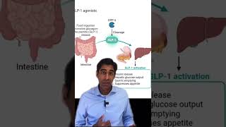 Ozempic and Wegovy Causing Stomach Paralysis Explained by Endocrinologist [upl. by Neile]