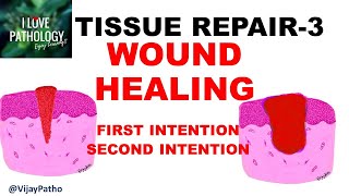 Wound Healing [upl. by Ojimmas124]