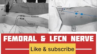 FEMORAL NERVE amp LFCN nerve conduction  nerve conduction study of femoral and LFCN [upl. by Cinom]