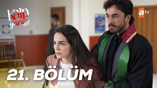 Kalp Yarası 21 Bölüm atvturkiye [upl. by Ayom]