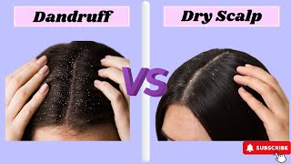 DANDRUFF VS DRY SCALP How To Spot the Difference [upl. by Ellek]