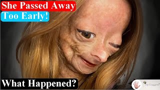 15YearsOld Youtube Star Adalia Rose Left us Forever  Her Last Videos  Body Bizarre [upl. by Ajax448]