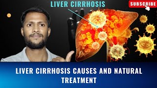 Liver Cirrhosis Causes amp Treatment  What Is liver Cirrhosis  liver Cirrhosis In English By Rahul [upl. by Aleina699]