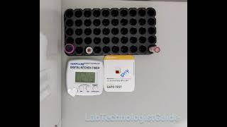 Glucose 6 phosphate test G6PD test [upl. by Chavaree269]