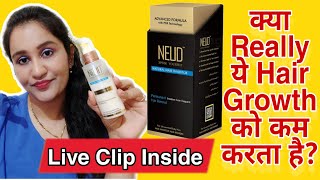 Neud Hair Inhibitor Review  My Experience With Neud Hair Inhibitor  Non Sponsored [upl. by Mohammed]