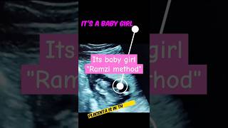 Its baby girl ultrasound  RAMZI THEORY shorts ultrasound genderreveal [upl. by Annirok]