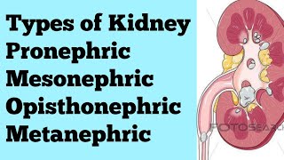 Types of kidney Pronephric Mesonephric Opisthonephric Metanephric for NEET BSc MSc CSIR [upl. by Enelyw]