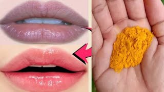 How To Get Pink Lips Naturally  Get Rid of Dark Pigmented Lips  Pink Lips Naturally at Home [upl. by Ardelia]