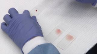 Making and staining blood smears [upl. by Aicatan]