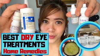 DRY EYES HOME REMEDIES l 7 Easy Tips for Dry Eye Treatment l Natural Remedies l Chabi Channel [upl. by Marlen]