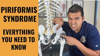 Piriformis Syndrome Everything You Absolutely Need To Know To Get Better [upl. by Oleta]